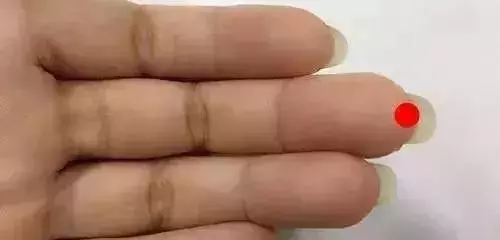 刮幾根手指,一次搞定十幾種病,太實用了!