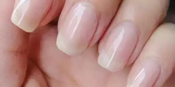 指甲上的月牙、豎紋、白點代表什麼?