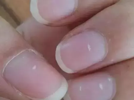 指甲上的月牙、豎紋、白點代表什麼?