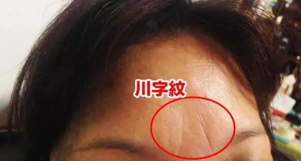 注意!你的額頭早就把你的命運暴露光了!有「川字紋」的人竟然都是這樣的......而「這種紋」命超好!