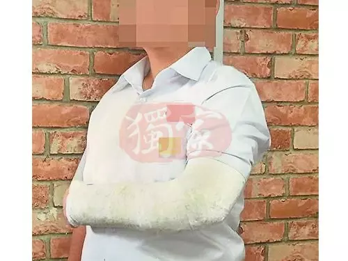 老師體罰用牛力 學生腕骨被打斷