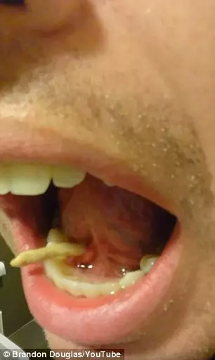 他照鏡子時感覺「怎麼舌頭下有硬物」,結果一用力…差點看吐了!
