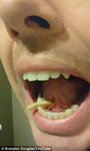 他照鏡子時感覺「怎麼舌頭下有硬物」,結果一用力…差點看吐了!
