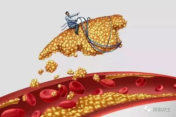 血管幹凈人不老,干好這4件事,幫血管洗澡澡