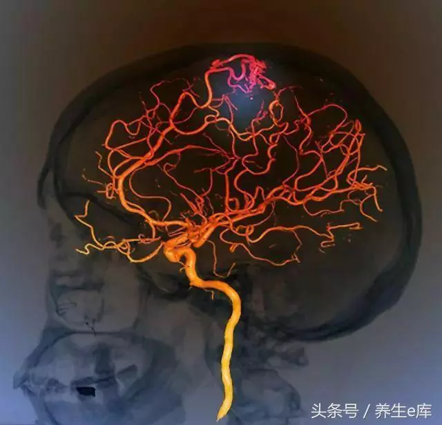 血壓高的人,身體有這5種表現,控制血壓,謹記晨起「三忌」!