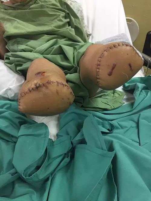 大馬某私人醫院醫療設備不齊全,醫護人員竟說:「沒有錢就放棄治療」!