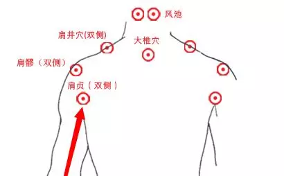 肩膀痛=「肩周炎」?每天用按2個穴位,7天肩周炎不來擾