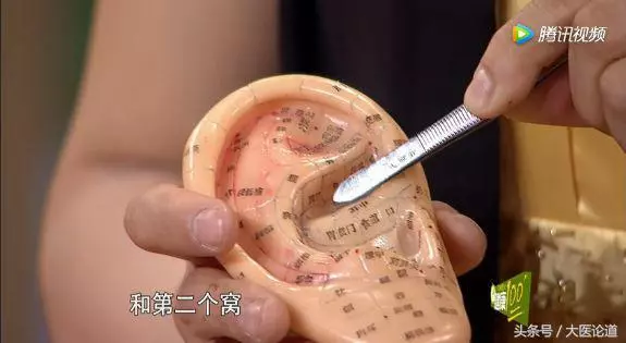 中華中醫藥學會專家:耳朵上有個補腎機關,堪比補藥