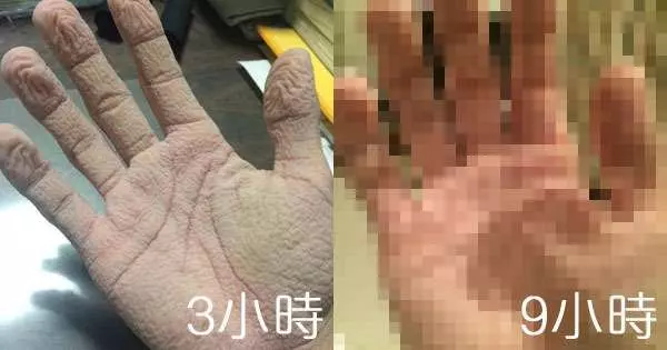 手泡在水裡變皺的極限在哪裡?日本網友超勇敢的實驗精神就算賣了雙手也要告訴大家這個答案。