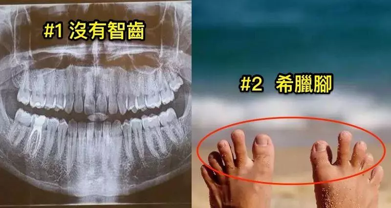 12種「只有被神特別眷顧」才會擁有的超罕見身體特徵。#12 「這種心臟」是萬中選一!