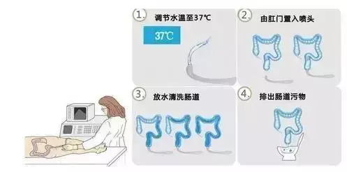 清腸雖好,但不要過度清腸反受其害!