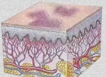 為什麼你的身上會無緣無故出現淤青?這4種情況最要命,一定注意