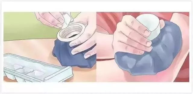 為什麼你的身上會無緣無故出現淤青?這4種情況最要命,一定注意