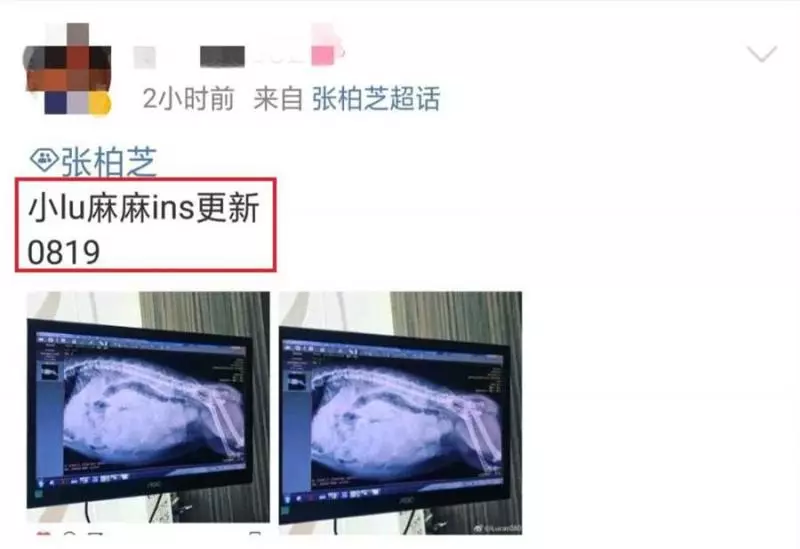 張柏芝疑似展開新戀情,深夜曬懷孕B超照迎接新成員,引起網友一片驚呼!