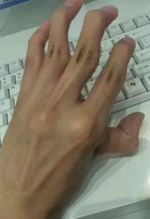 8個一般人「手骨折都做不到」的奇葩手勢 能做到「半數以上」者絕對是天選之人啊!