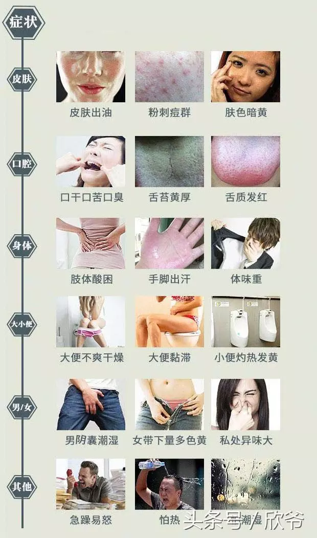 濕氣的典型變現是什麼?快來對照查查!