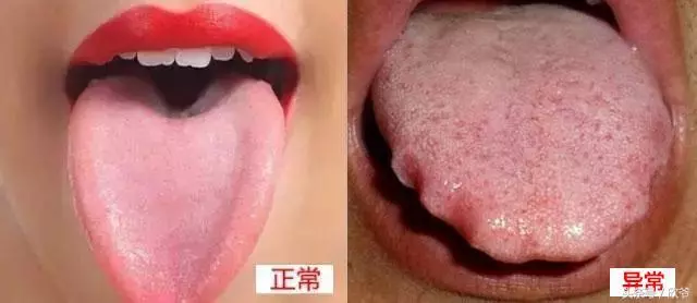 濕氣的典型變現是什麼?快來對照查查!