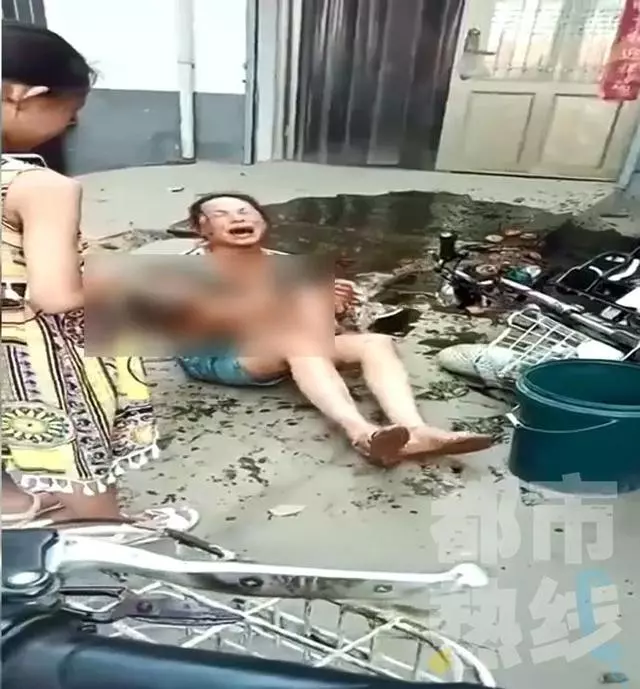 電動車撞翻早餐攤油鍋 1歲半男娃被熱油從頭澆下