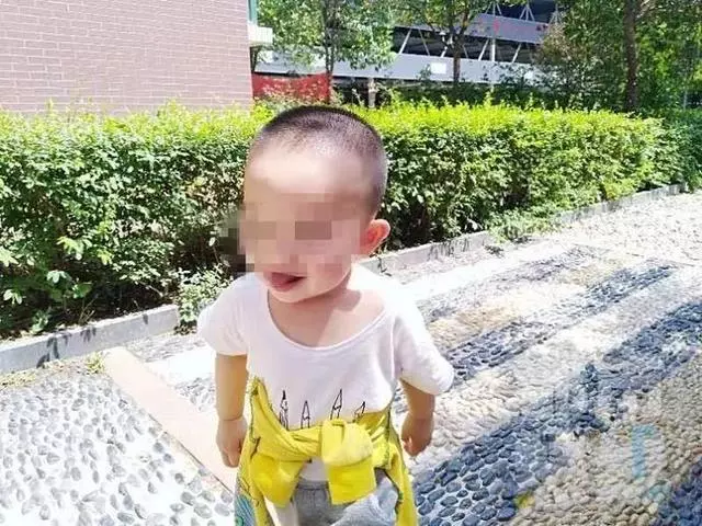 電動車撞翻早餐攤油鍋 1歲半男娃被熱油從頭澆下
