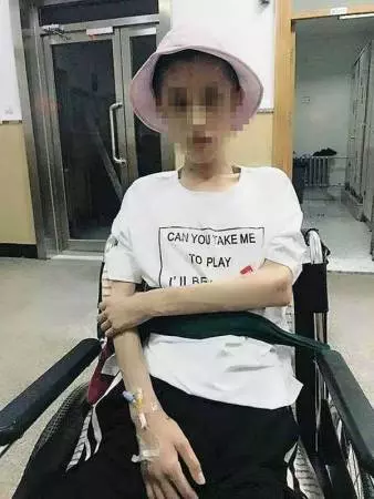 少女瘋狂減肥剩25公斤 腦組織退化如60歲老人
