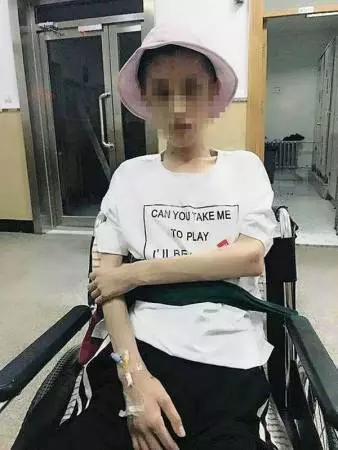 少女瘋狂減肥剩25公斤 腦組織退化如60歲老人 -
