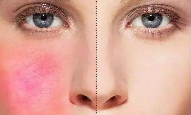 洗澡搓出來的「泥」是什麼?未必是身體髒!準確答案多數人都猜錯