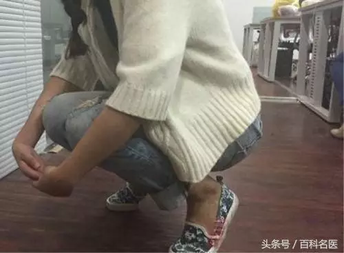 13歲女孩深蹲百次後致橫紋肌溶解!網友:心安理得不運動了!