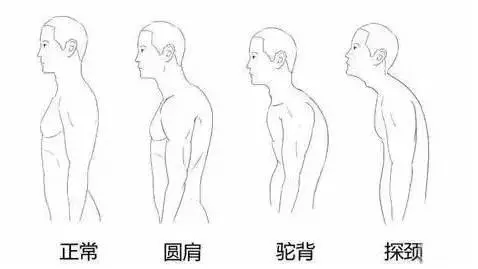 「脖子前傾」毀人無數,3個動作拯救你的氣質!