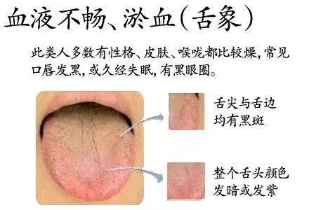 老中醫為什麼要望舌診病,舌頭「表現不好」人體健康成疑