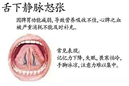 老中醫為什麼要望舌診病,舌頭「表現不好」人體健康成疑