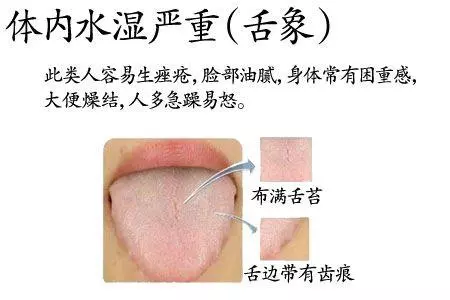 老中醫為什麼要望舌診病,舌頭「表現不好」人體健康成疑