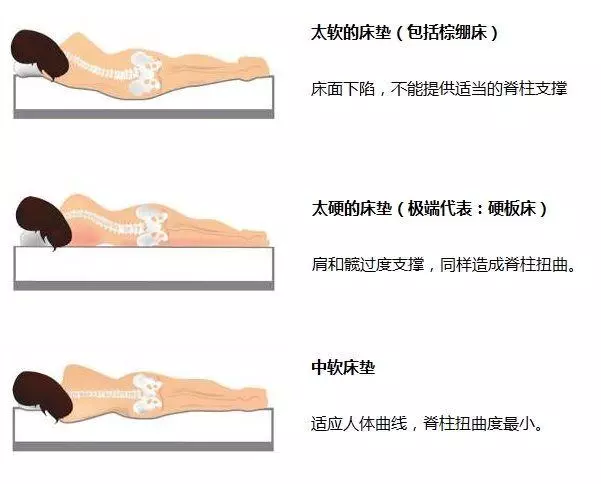 腰椎間盤患者,睡覺有訣竅!——達到「臥如弓」最好