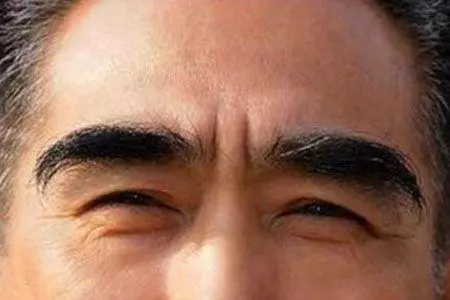 這裡的毛越多越健康,壞習慣也能讓你保持年輕,你有這個嗎