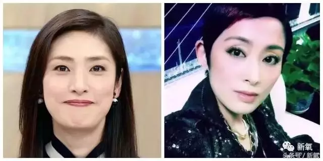 跟以前看起來不同,你們發現了嘛?繼王祖賢之後張敏也「整形」了,這些經典美人能不能放過自己!