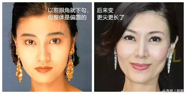 跟以前看起來不同,你們發現了嘛?繼王祖賢之後張敏也「整形」了,這些經典美人能不能放過自己!