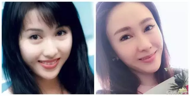 跟以前看起來不同,你們發現了嘛?繼王祖賢之後張敏也「整形」了,這些經典美人能不能放過自己!