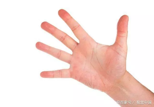 肝不好的人,身上可能會出現「2紅1臭」,若你都沒有可能肝還不錯