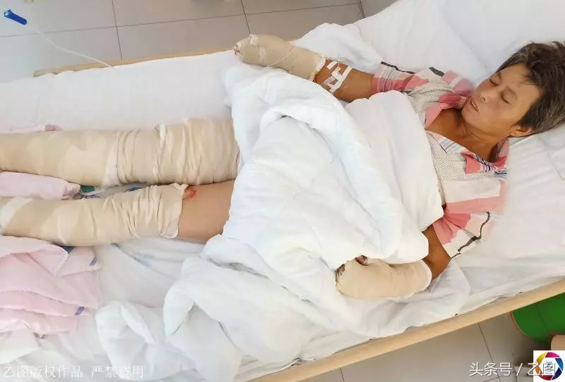 午睡奶奶開了一下空調,美貌小女孩變成紗布人,打工父母傷心欲絕