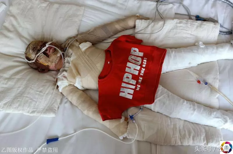 午睡奶奶開了一下空調,美貌小女孩變成紗布人,打工父母傷心欲絕