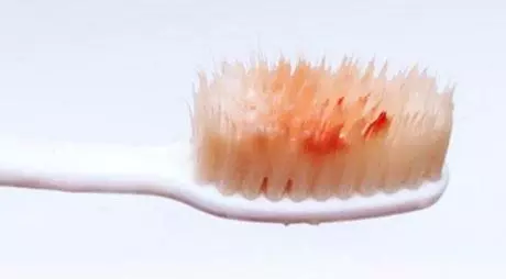 提醒:刷牙時不注意這4點,遲早會讓自己「一口爛牙」!