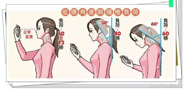 頸椎酸疼難忍,一個礦泉水瓶幫你解救頸椎!