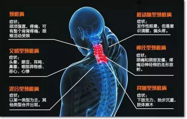 頸椎不好的人,這3種食物最好別碰,否則頸椎疼起來,生不如死!