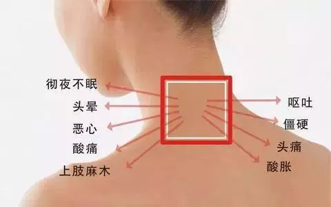 頸椎不好的人,這3種食物最好別碰,否則頸椎疼起來,生不如死!