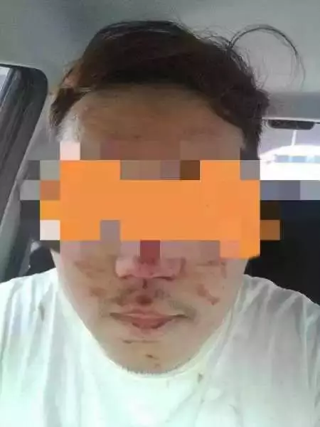 危險駕駛不甘被鳴笛,路霸攔車揍傷工程師