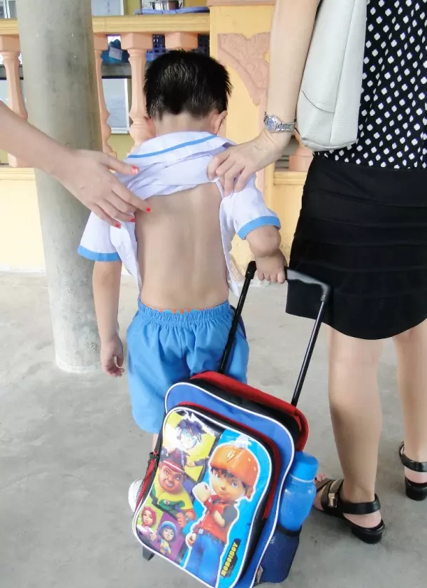 保姆虐打5歲小男孩導致全身傷痕累累 惡毒保姆否認打人