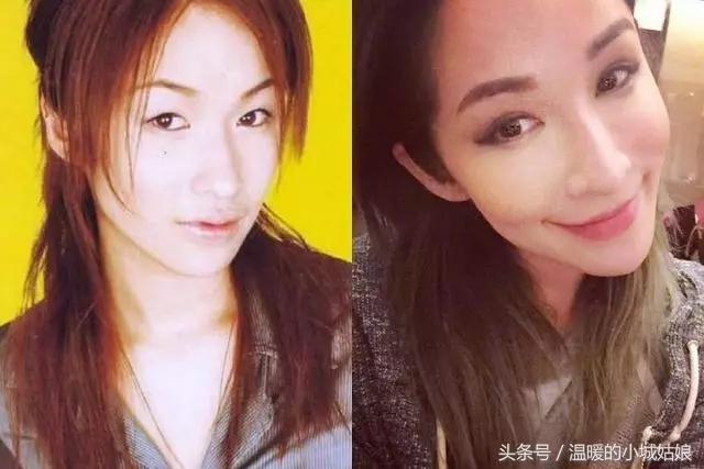 「割過雙眼皮」的10位明星,戚薇美出新高度,薛之謙像換了一個人!