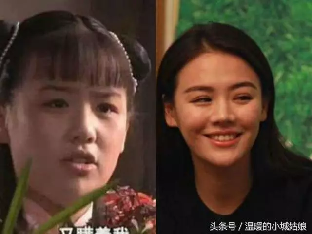 「割過雙眼皮」的10位明星,戚薇美出新高度,薛之謙像換了一個人!