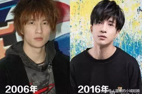 「割過雙眼皮」的10位明星,戚薇美出新高度,薛之謙像換了一個人!