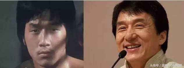 「割過雙眼皮」的10位明星,戚薇美出新高度,薛之謙像換了一個人!