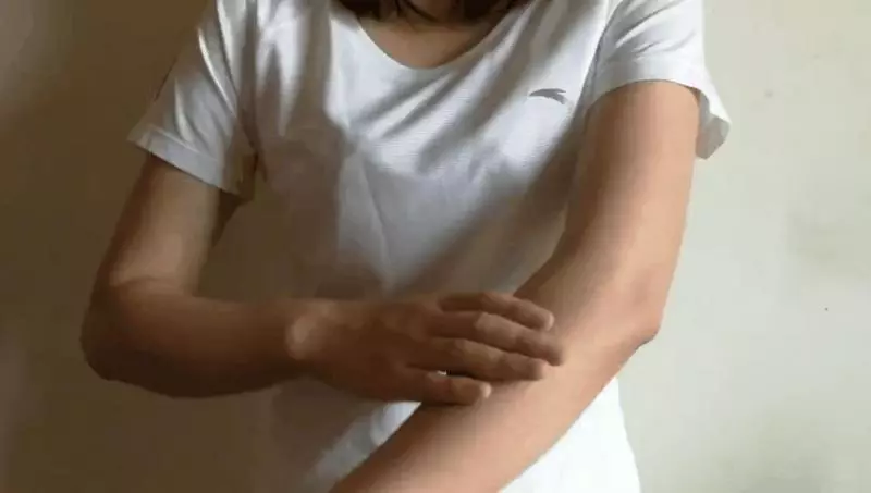 阿嫲祖傳秘方? 被蚊子咬後,止癢最效的方法!第5種方法,你一定從小到大都try過!